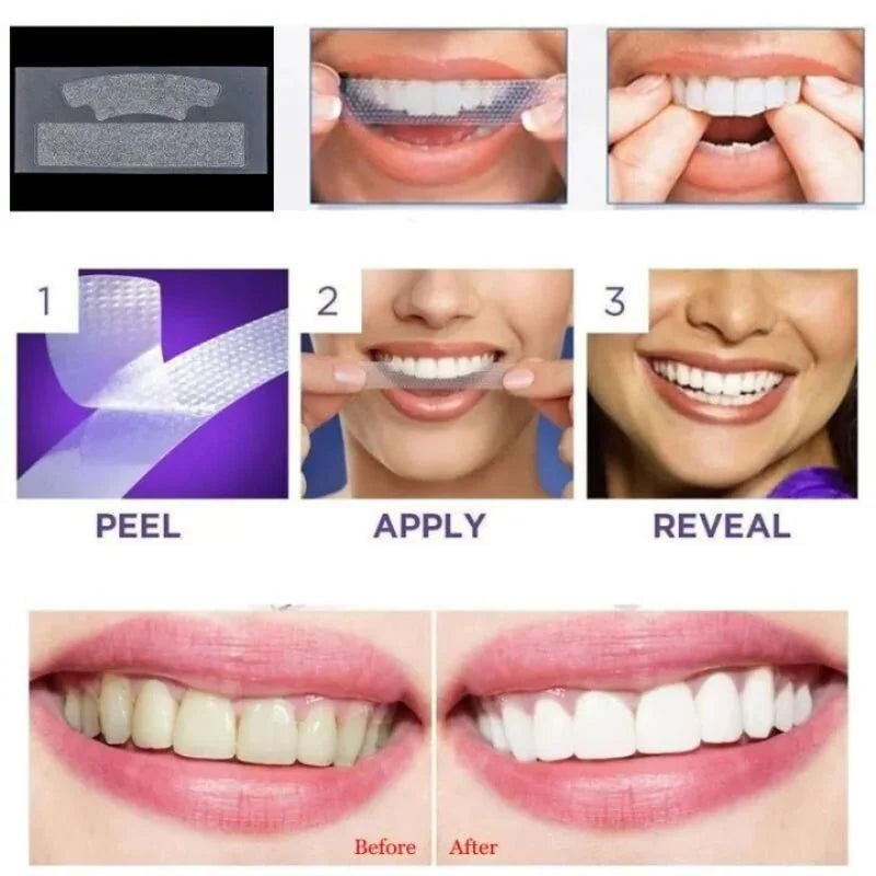 Gegemoon 5D Teeth Whitening Strips | Professional 5-Day Whitening Kit | Enamel Safe Teeth Whitening Strips | Deep Stain Removal | Mint Flavor | 7 Pairs