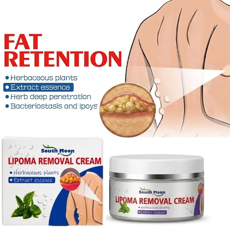Lipoma Removal  Cream | Herbal Skin Care Cream for Smooth & Nourished Skin | Fast-Absorbing Formula | For Neck & Body | 50g